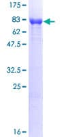 Human PGM1 / Phosphoglucomutase 1 Protein (Recombinant GST)