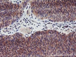 LPL / Lipoprotein Lipase Antibody (clone OTI3C8, Carrier-free)