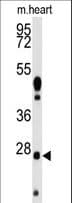 Polyclonal Rabbit anti-Human WDYHV1 Antibody (aa106-136, IHC, WB)