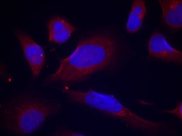 NOS3 / eNOS Antibody (phospho-Ser1177)