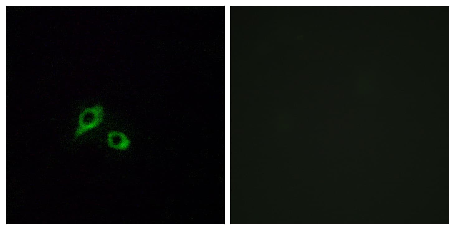 Polyclonal Rabbit anti-Human GIPR / GIP Receptor Antibody (aa93-142, IHC, IF)