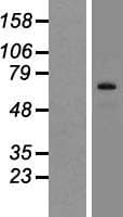 SIX5 Protein (Over-Expression Lysate Myc-DDK (Flag))