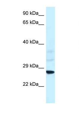 Polyclonal Rabbit anti-Rat SNF8 / EAP30 Antibody (aa25-74, WB)
