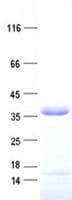 Human NTHL1 Protein (Recombinant His, N-Terminal)