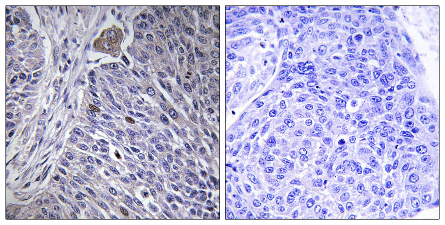 Polyclonal Rabbit anti-Human HNRNPDL / hnRNP D Antibody (aa241-290, IHC)