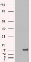 IHC-plus™ CRYAB / Alpha B Crystallin Antibody (clone 4A6)