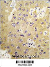 SGK3 Antibody (aa1-30)