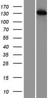 TIP120 / CAND1 Protein (Over-Expression Lysate Myc-DDK (Flag))
