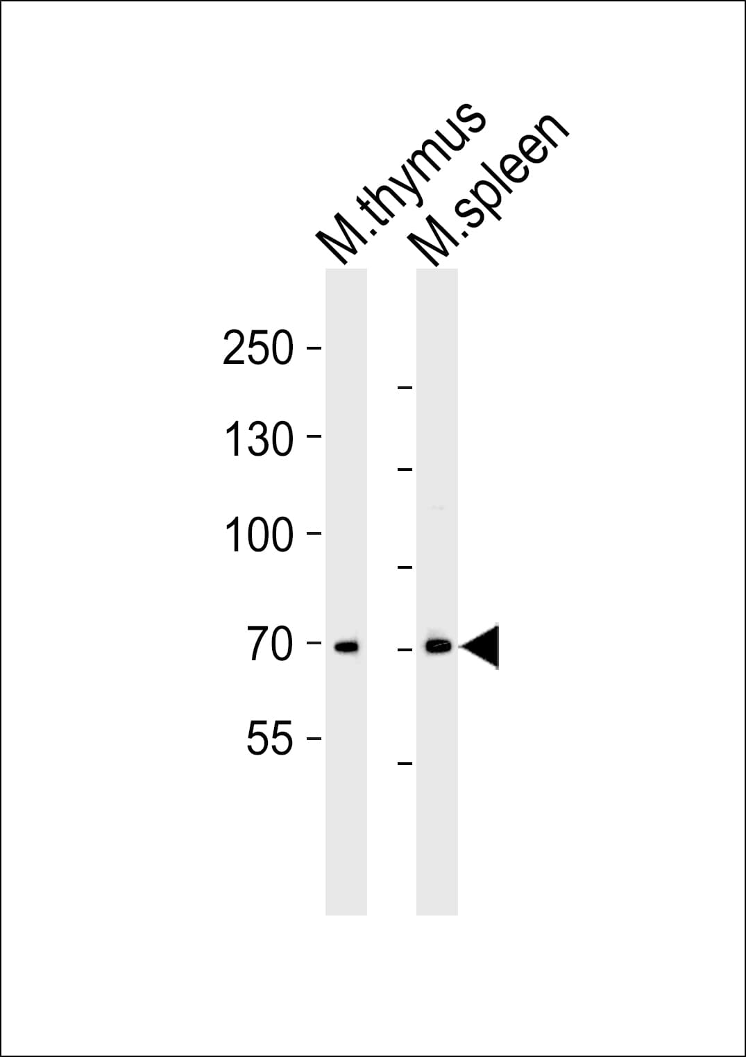 Polyclonal Rabbit anti-Human ITK / EMT Antibody (aa156-190, WB)