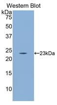 CD8B / CD8 Beta Antibody (aa21-208)