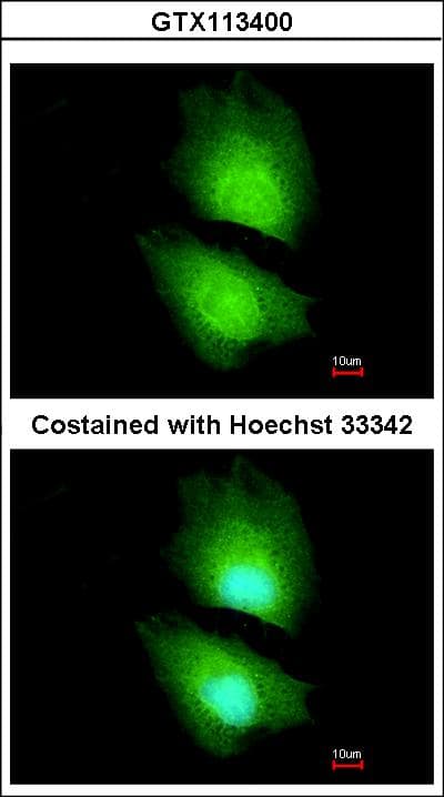 Polyclonal Rabbit anti-Human CBS Antibody (aa39-251, IHC, WB)
