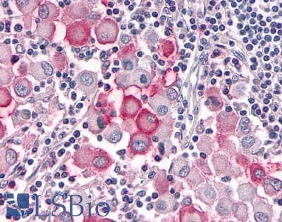 PathPlus™ OR10R2 Antibody (Extracellular Domain)