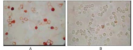 HHV-8 ORF62 Antibody (clone 5B7B6)