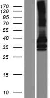 NR1I3 / CAR Protein (Over-Expression Lysate Myc-DDK (Flag))