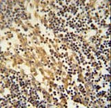 TNFAIP2 Antibody (aa456-484)