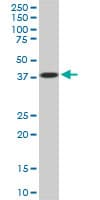 Monoclonal Mouse anti-Human PCYT1A / CCT Alpha Antibody (clone 6E6, WB)
