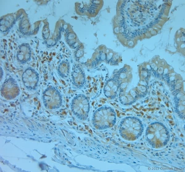 Polyclonal Rabbit anti-Human REEP5 Antibody (aa150-189, IHC)
