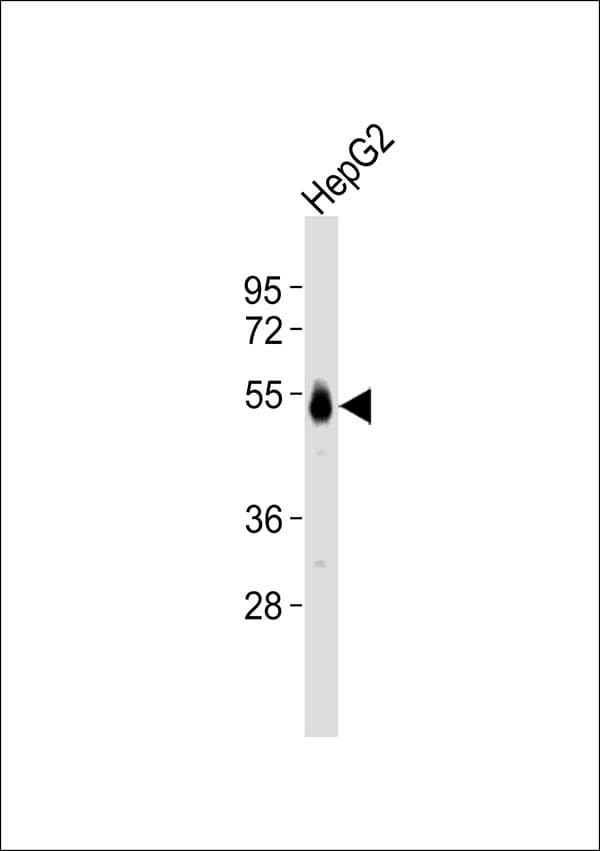 ST6GAL1 / CD75 Antibody