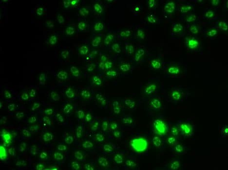 ER81 / ETV1 Antibody