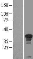 CCNH / Cyclin H Protein (Over-Expression Lysate Myc-DDK (Flag))