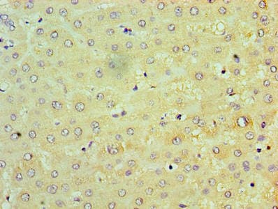 NAK / TBK1 Antibody