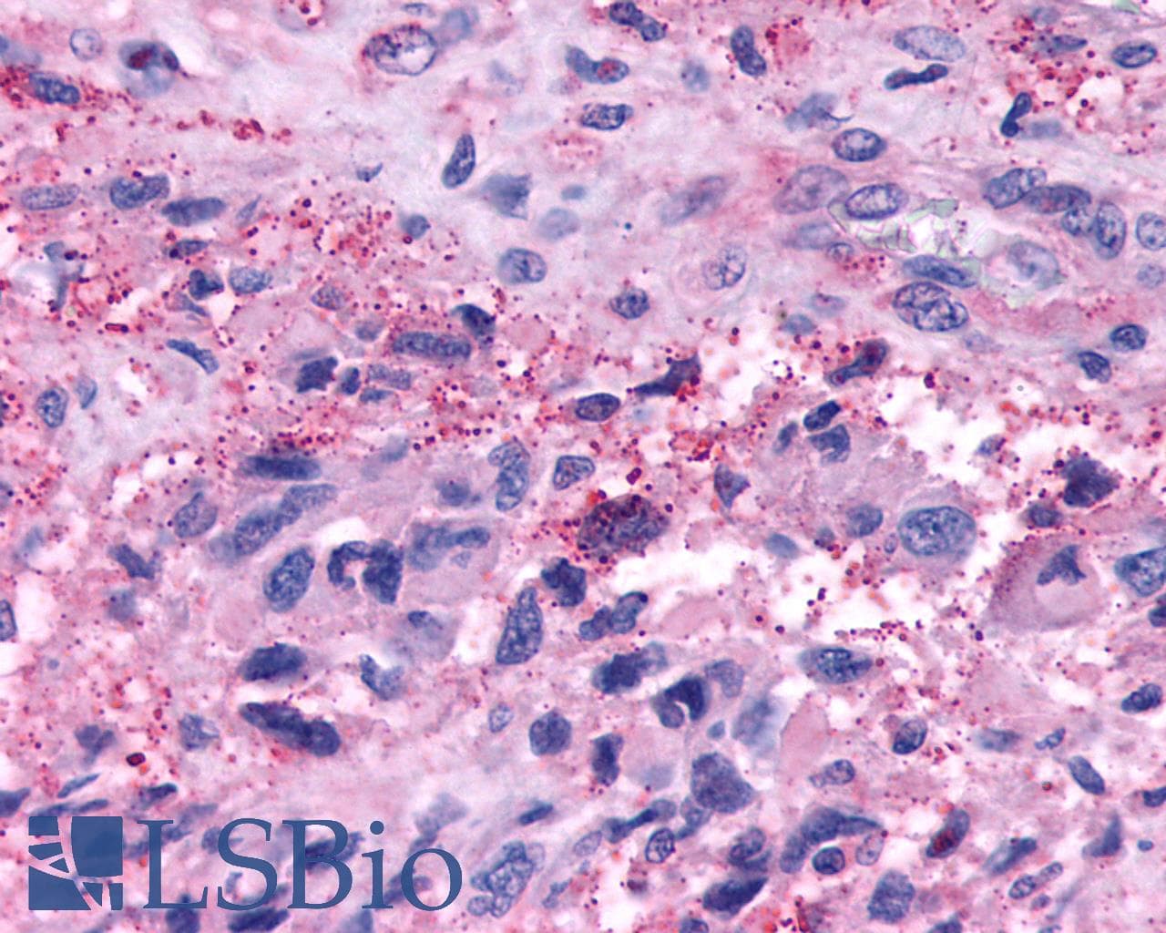 PathPlus™ Polyclonal Rabbit anti-Human HTR7 / 5HT7 Receptor Antibody (C-Terminus, IHC)