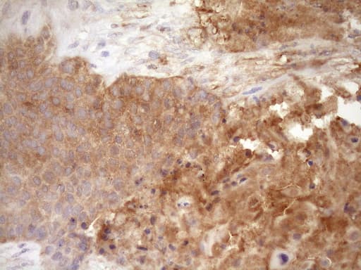 Monoclonal Mouse anti-Human FSCN1 / Fascin Antibody (clone OTI3B4, IHC, WB)