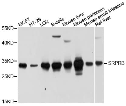 SRPRB Antibody