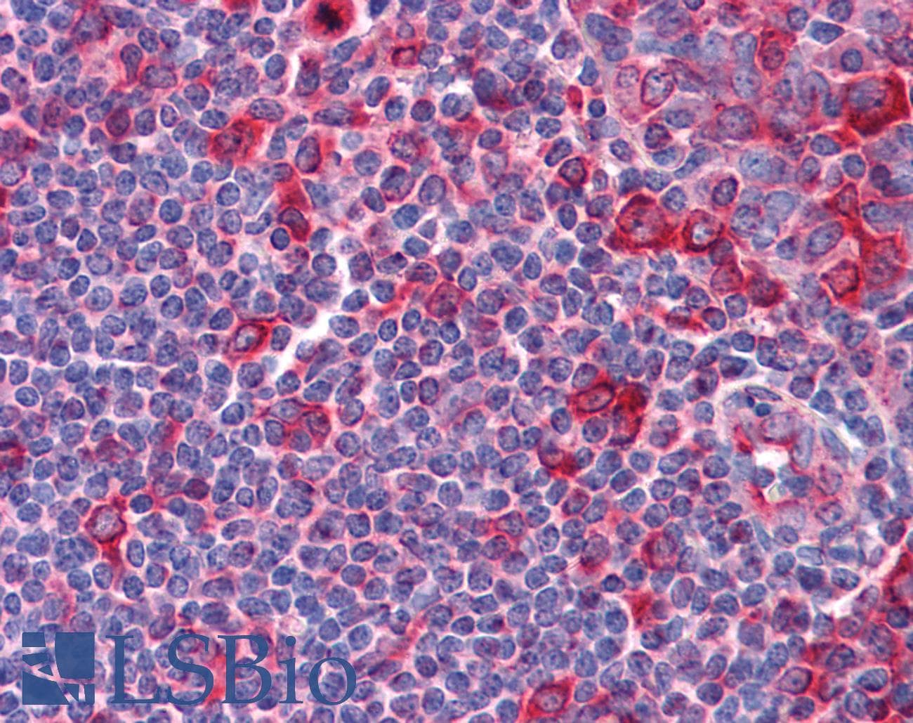 IHC-plus™ Alpha Tubulin Antibody (clone DM1A)
