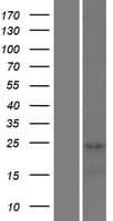 Human STAG3 Protein (Over-Expression Lysate Myc-DDK (Flag))
