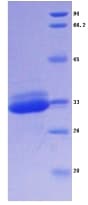 Mouse CTSS / Cathepsin S Protein (Recombinant His-S)