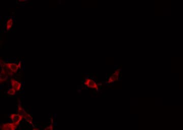 Polyclonal Rabbit anti-Human ST14 / Matriptase Antibody (IHC, IF, WB)