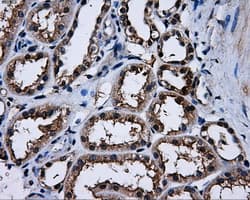 PME-1 / PPME1 Antibody (clone OTI6H5)