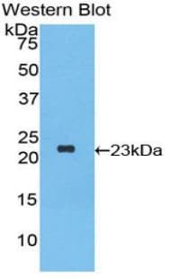 IFNA2 / Interferon Alpha 2 Antibody (aa24-188, APC)