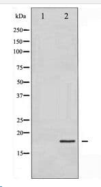 Polyclonal Rabbit anti-Human CFL1 / Cofilin Antibody (WB)