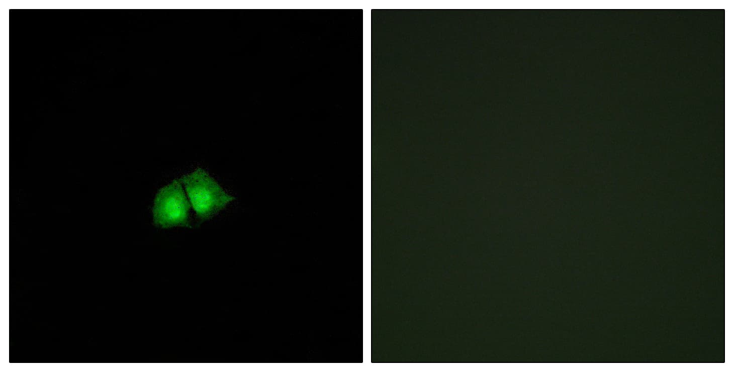 COPS2 / TRIP15 / ALIEN Antibody (aa181-230)