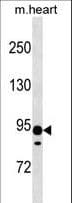 Polyclonal Rabbit anti-Human XYLT2 Antibody (aa29-58, WB)