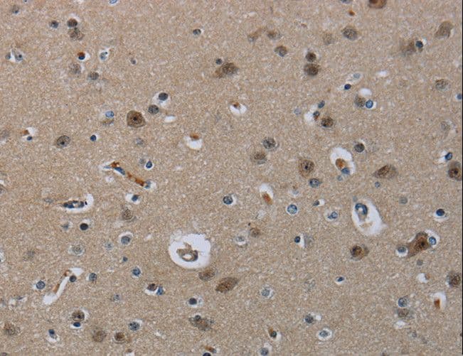 MRE11A / MRE11 Antibody