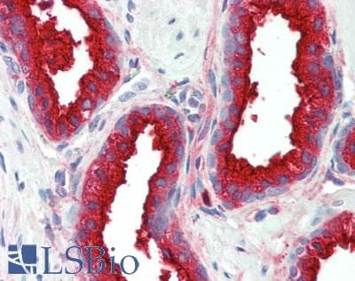 IHC-plus™ Polyclonal Rabbit anti-Human PAP2a / PPAP2A Antibody (aa270-304, IHC, WB)