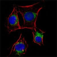 NGFR / CD271 / TNR16 Antibody (clone 2F1C2)