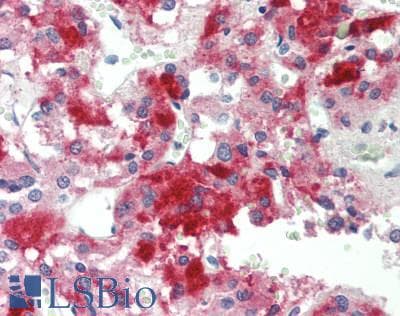 IHC-plus™ RAMP3 Antibody