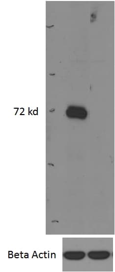 IRAK3 / IRAKM / IRAK-M Antibody (aa582-593)