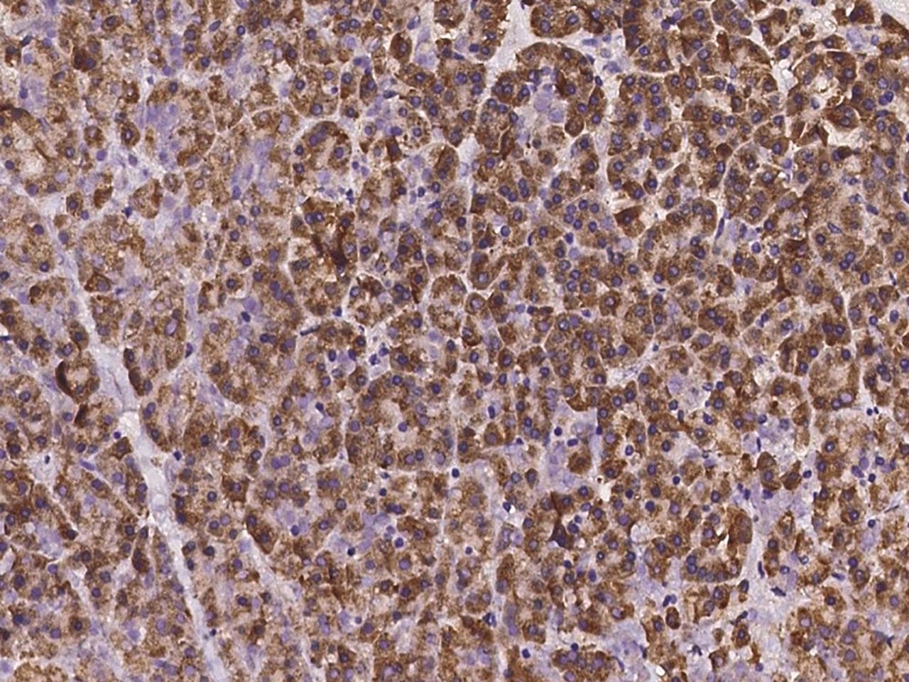 Polyclonal Rabbit anti-Human MCFD2 Antibody (IHC)