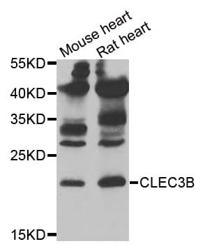 CLEC3B / Tetranectin Antibody