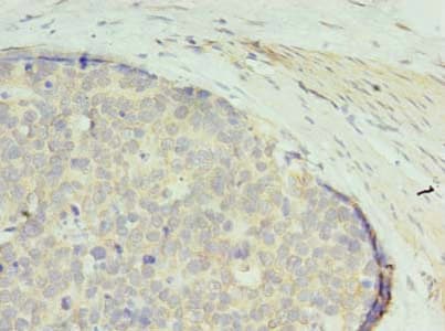 GTPBP6 Antibody