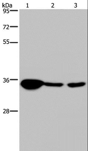 LZTFL1 Antibody