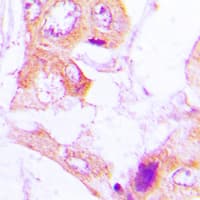 Polyclonal Rabbit anti-Human Acetyl-CoA Carboxylase / ACC Antibody (phospho-Ser80, IHC, WB)