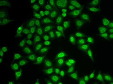 Polyclonal Rabbit anti-Human PSMB9 Antibody (IHC, IF, WB)