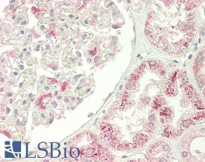 IHC-plus™ PH / PAH Antibody (aa1-315)