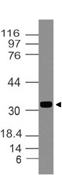 TIMP1 Antibody